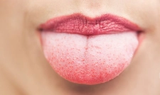 Dudak Uyuşması Nedenleri ve Tedavisi