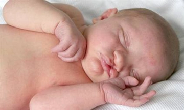 Dudak Damak Yarığı Belirtileri ve Tedavisi