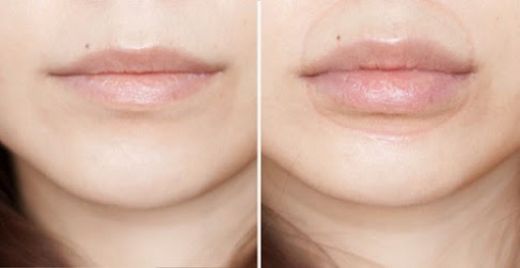 Dudak Dolgunlaştırma Egzersizleri ve Yöntemleri