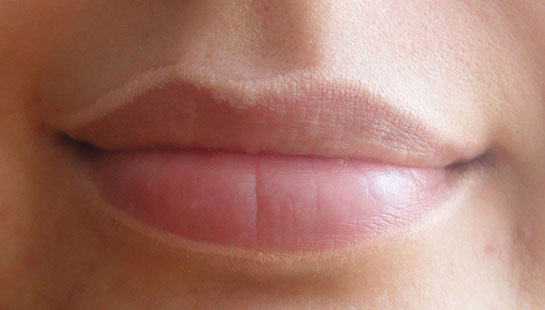 Dudak Kuruması Nedenleri ve Tedavisi